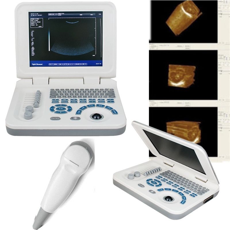 Laptop 10" Ultrasound Scanner Machine + Micro-convex Probe CE 2 Years W & Bag DIAGNOSTIC ULTRASOUND MACHINES FOR SALE