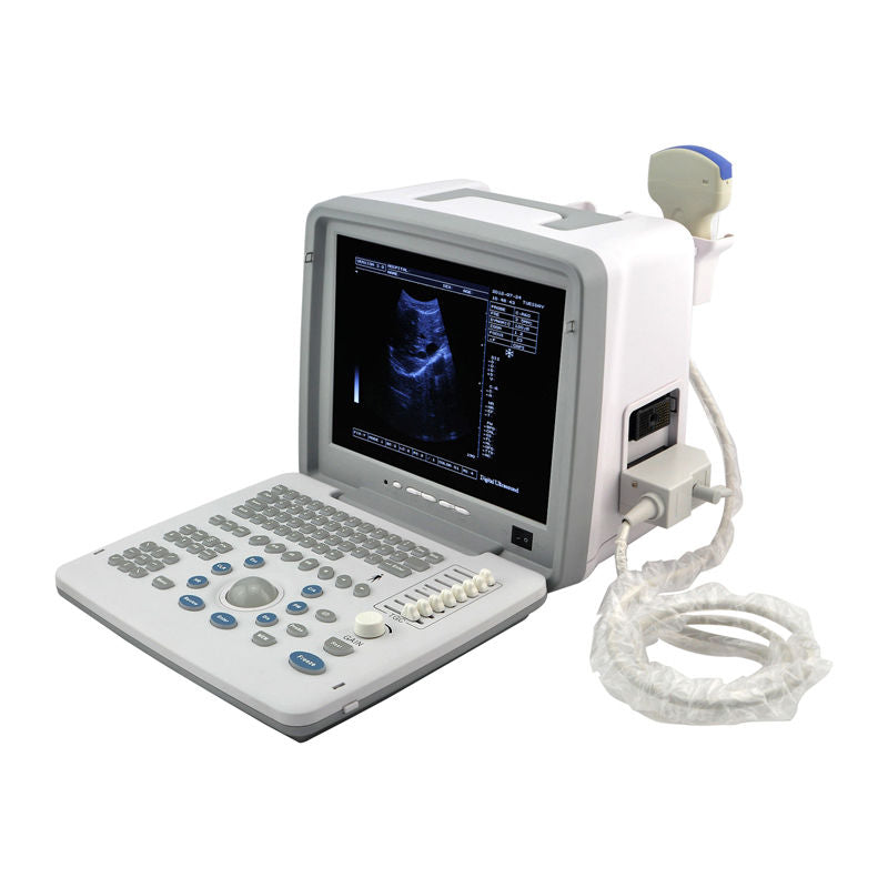 portable B Ultrasound Machine/Scanner Convex Probe ,Optional linear 3D Software 190891457189 DIAGNOSTIC ULTRASOUND MACHINES FOR SALE