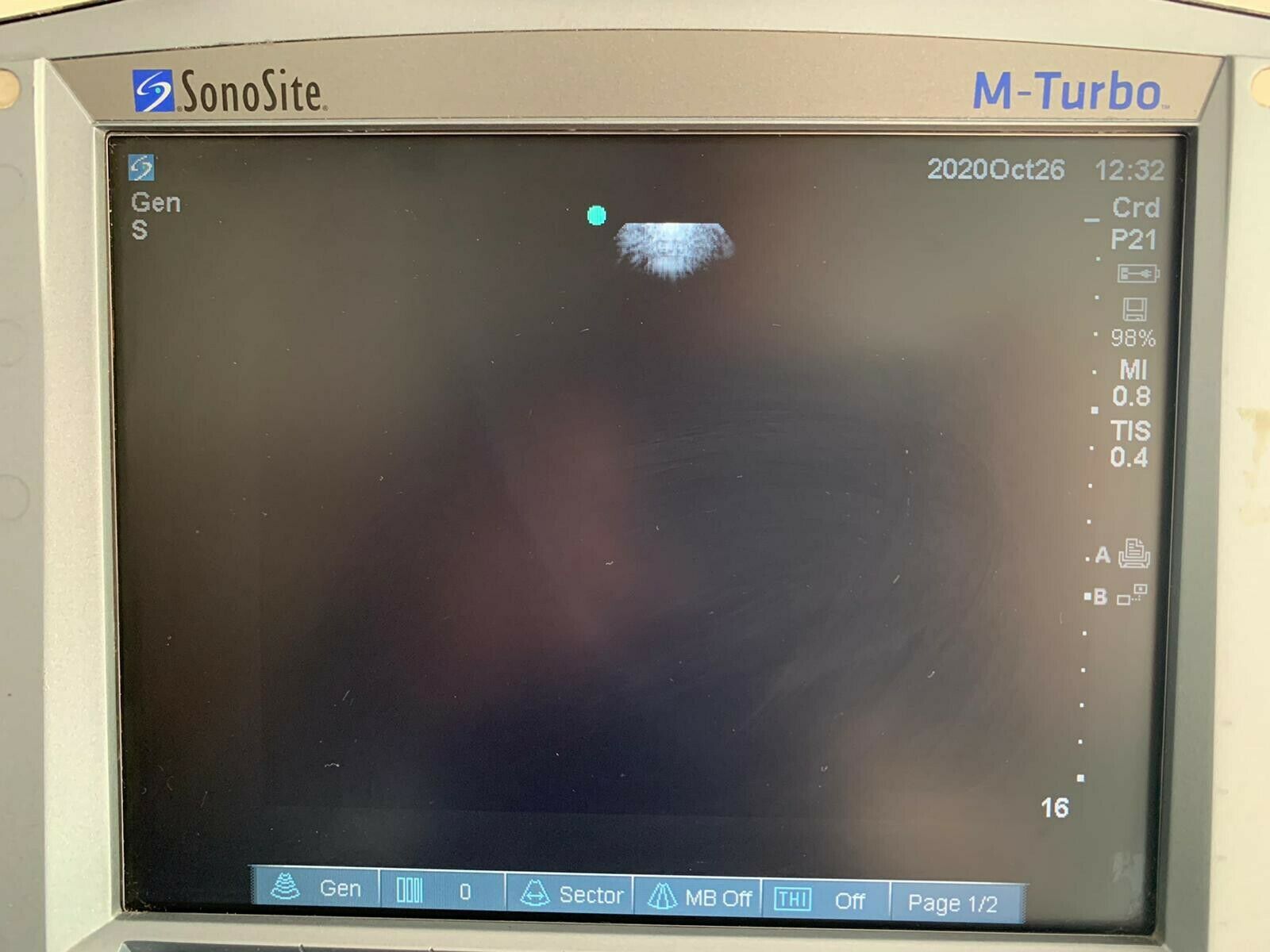 Sonosite P21x Ultrasound Probe Cardiac Transducer for Sonosite M-Turbo or Edge DIAGNOSTIC ULTRASOUND MACHINES FOR SALE