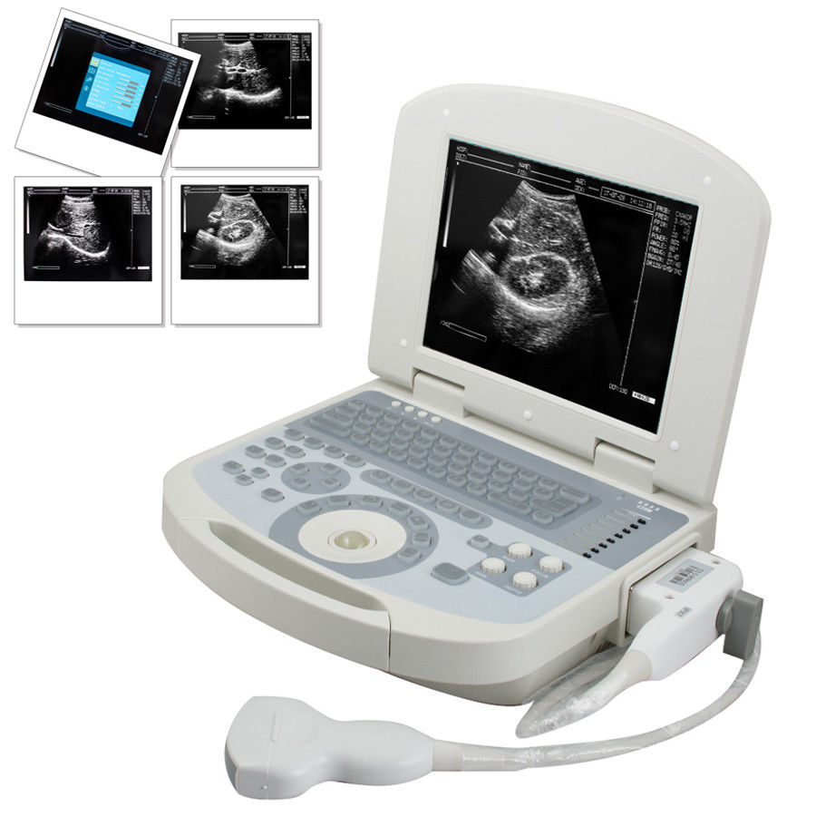 Portable 3D Digital Laptop Ultrasound Scanner Machine Convex Probe Abdominal USA 190891767165 DIAGNOSTIC ULTRASOUND MACHINES FOR SALE