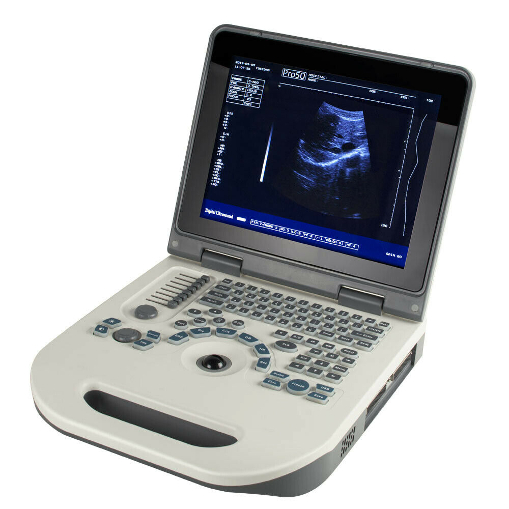 Portable Ultrasound Scanner Laptop Machine Safty Ultrasonic System+Convex Probe DIAGNOSTIC ULTRASOUND MACHINES FOR SALE