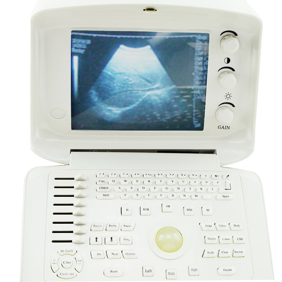 Digital Portable Ultrasound Scanner Linear Probes/Sensors with 3D Worksation CE 190891353023 DIAGNOSTIC ULTRASOUND MACHINES FOR SALE