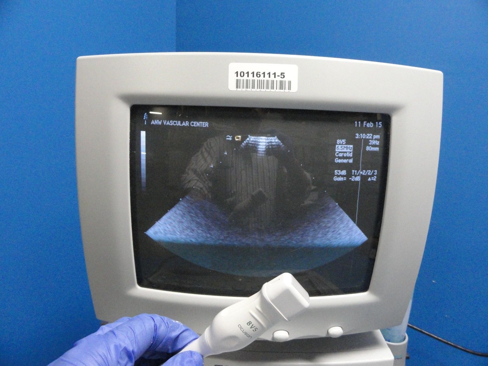 Acuson 8V5 Ultrasound Transducer W/ Pinless Connector for Acuson Sequoia (8590) DIAGNOSTIC ULTRASOUND MACHINES FOR SALE