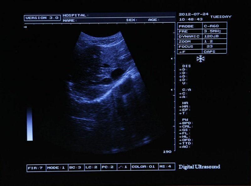 Full Digital Laptop Machine Ultrasound Scanner +Transvaginal Probe+3D Worksation 190891867513 DIAGNOSTIC ULTRASOUND MACHINES FOR SALE