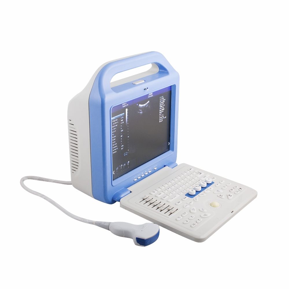 Laptop Color Doppler Ultrasonic Ultrasound Scanner Convex Linear 2 Probes  A+ DIAGNOSTIC ULTRASOUND MACHINES FOR SALE