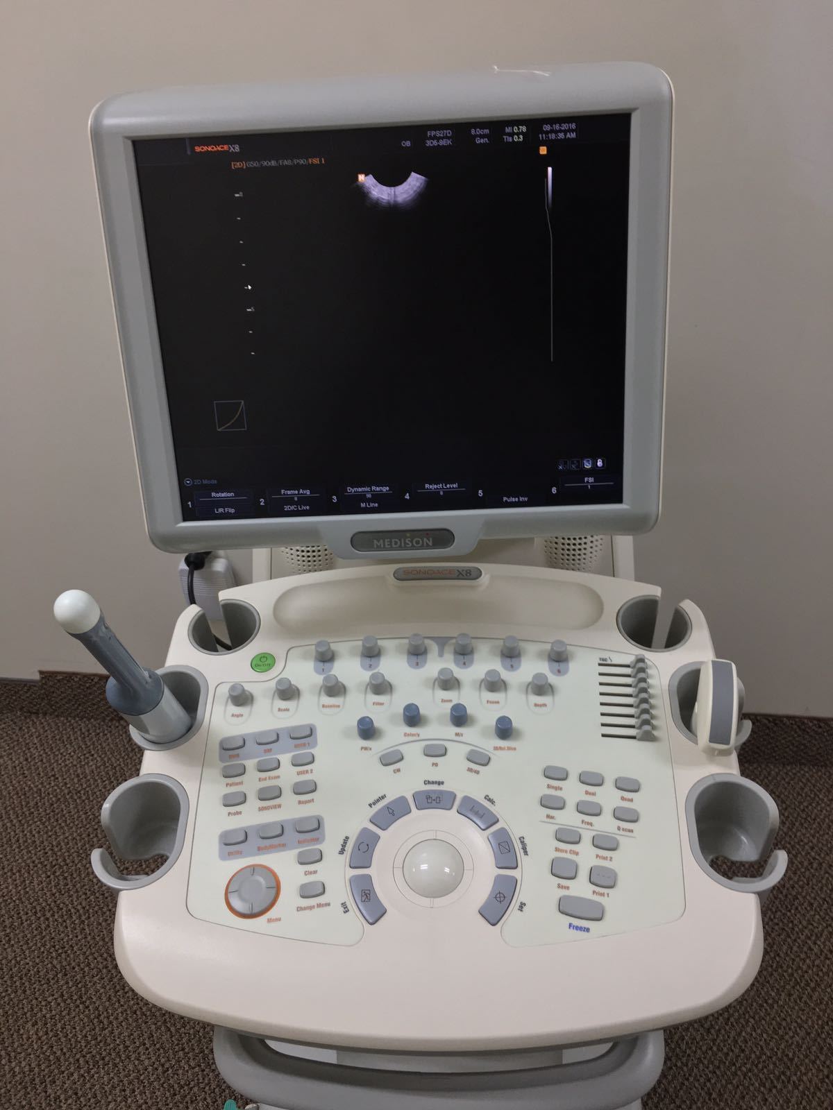 Medison SonoAce X8 OB/Gyn Ultrasound System w/ 3D5-9EK, 3D/4D, C2-8 Probes DIAGNOSTIC ULTRASOUND MACHINES FOR SALE