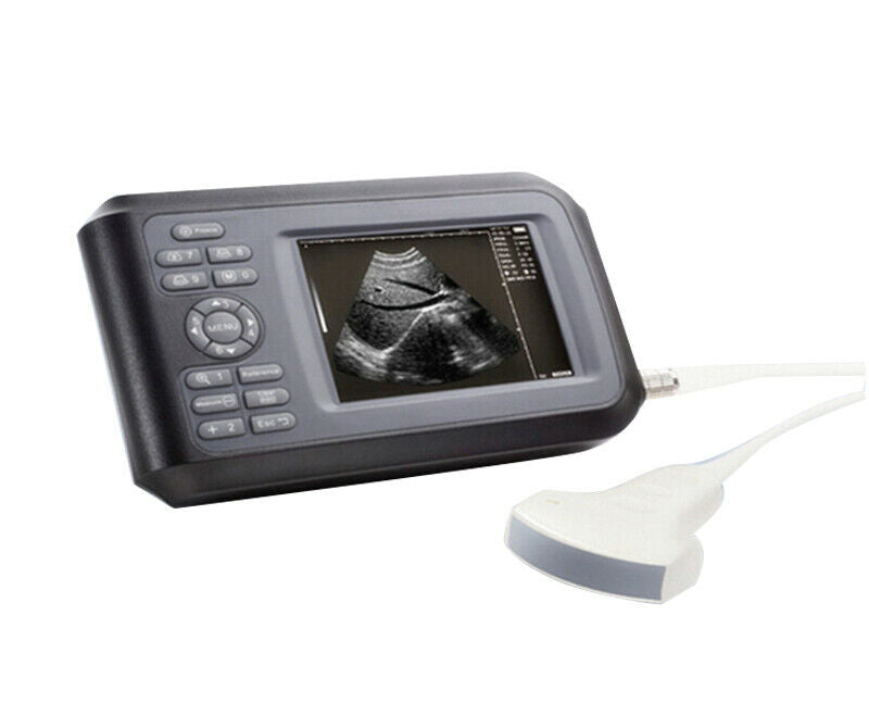 Pro Digital Ultrasound Scanner+Convex Probe Pregnancy Handheld Monitor Machine DIAGNOSTIC ULTRASOUND MACHINES FOR SALE