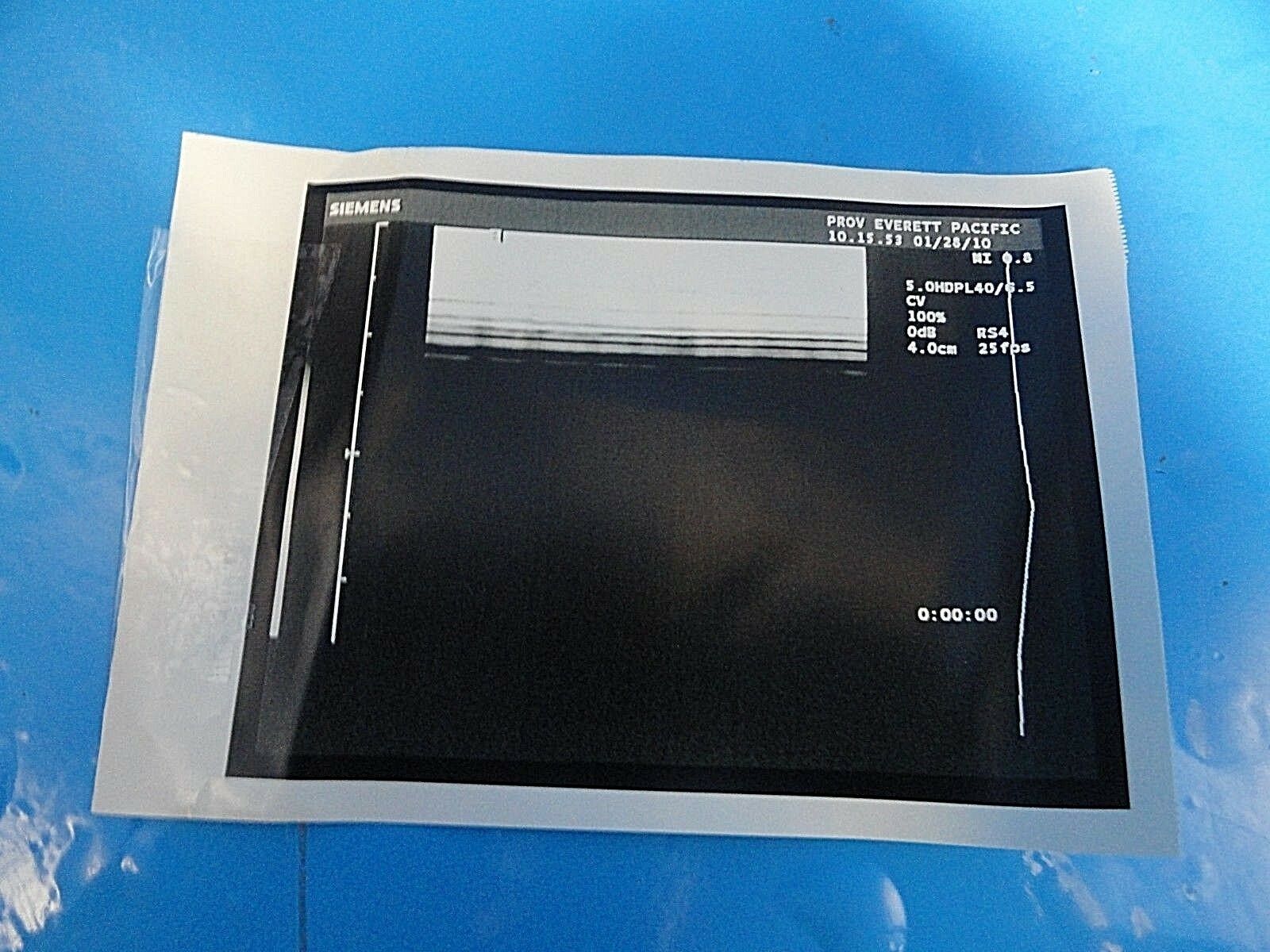 Siemens 5.0HDPL40 Linear Array Ultrasound Transducer for Sonoline Elegra ~15758 DIAGNOSTIC ULTRASOUND MACHINES FOR SALE