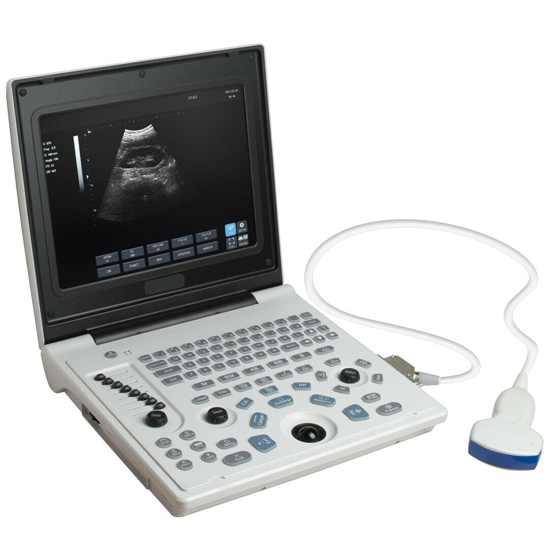 Portable 12''LED Screen Full Digital Ultrasound Scanner + 3.5MHz Convex Probe DIAGNOSTIC ULTRASOUND MACHINES FOR SALE