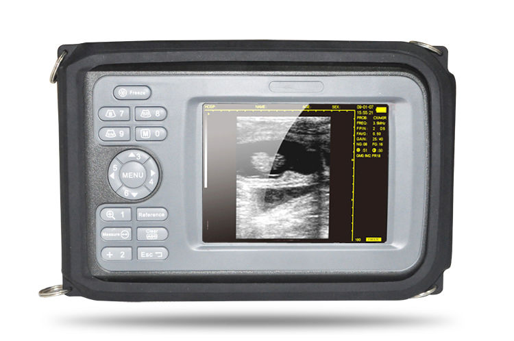 Hospital Medical Laptop Ultrasound Scanner Machine System Convex Probe Abdominal 190891827272 DIAGNOSTIC ULTRASOUND MACHINES FOR SALE