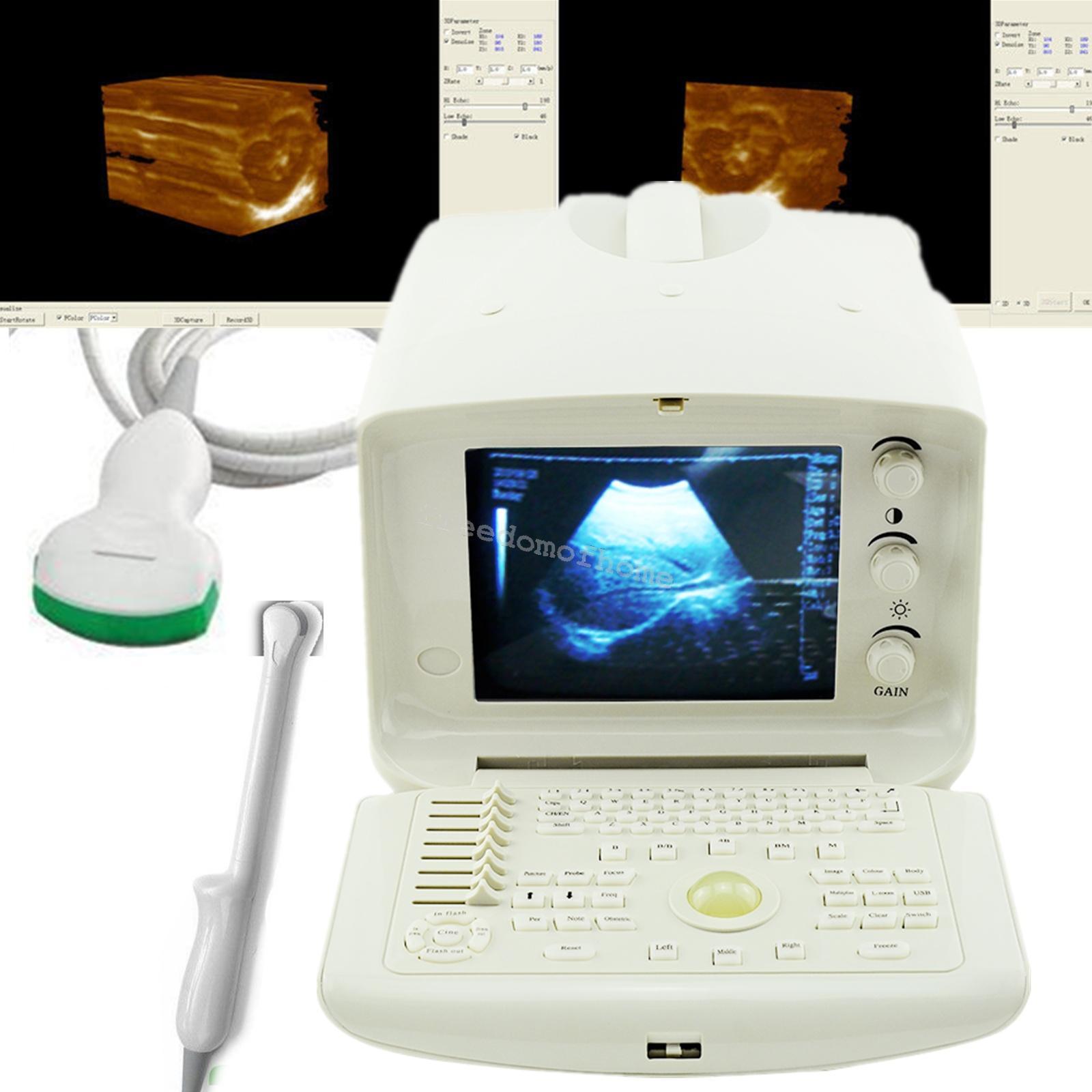 Full Digital Portable Ultrasound Scanner machine +Convex + Vignial  2 Probes+3D DIAGNOSTIC ULTRASOUND MACHINES FOR SALE