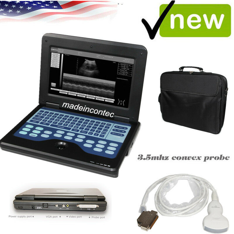 Portable Laptop Digital Ultrasound Scanner High Resolution,Convex/abdominal Prob DIAGNOSTIC ULTRASOUND MACHINES FOR SALE