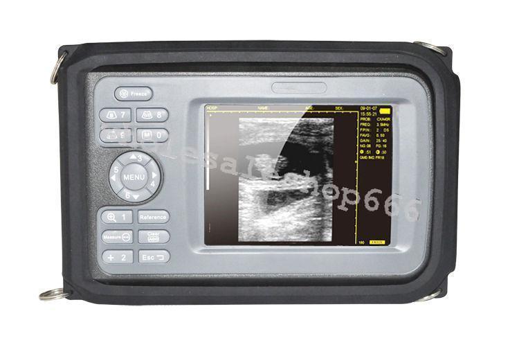 Portable Handheld Digital Ultrasound HandScan Scanner +Convex Probe Obstetrics DIAGNOSTIC ULTRASOUND MACHINES FOR SALE