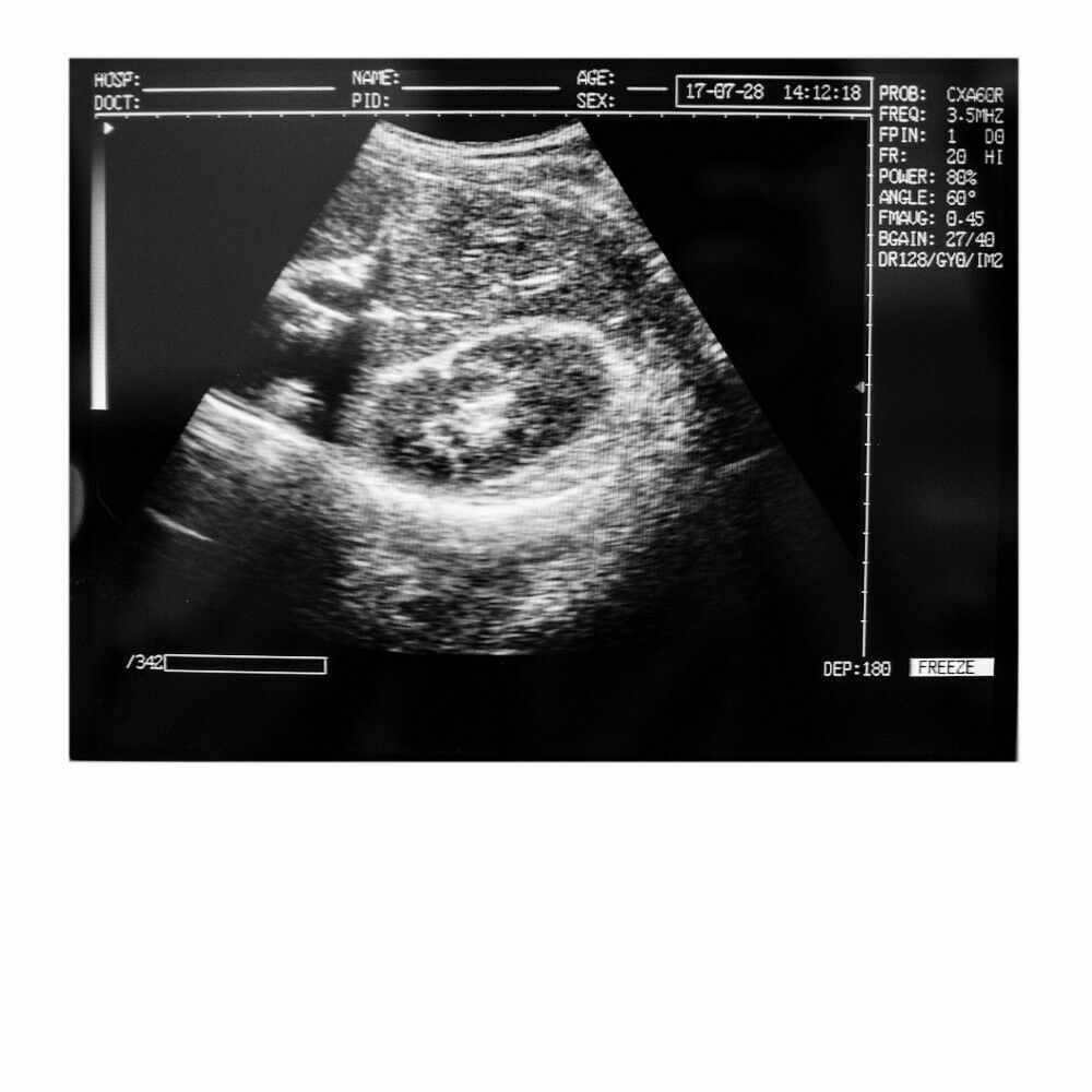 Portable Medical Laptop Diagnostic Ultrasound Scanner 3.5 Convex probe+Free 3D DIAGNOSTIC ULTRASOUND MACHINES FOR SALE