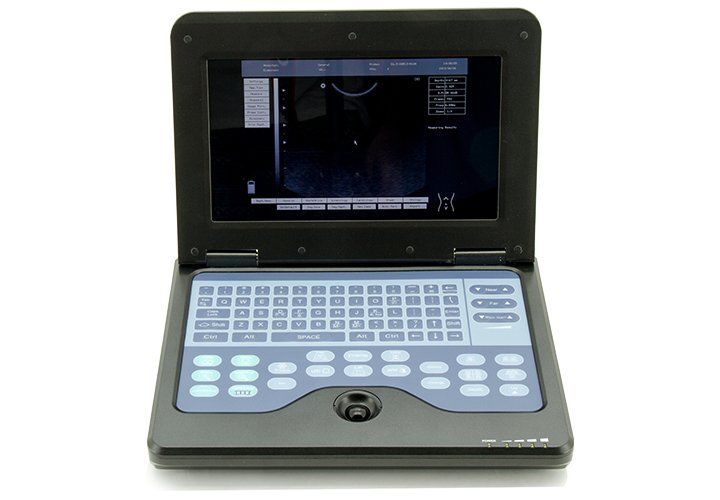 Digital Portable Laptop Ultrasound Scanner Machine 7.5M Linear Probe 600P2 CE 658126923446 DIAGNOSTIC ULTRASOUND MACHINES FOR SALE