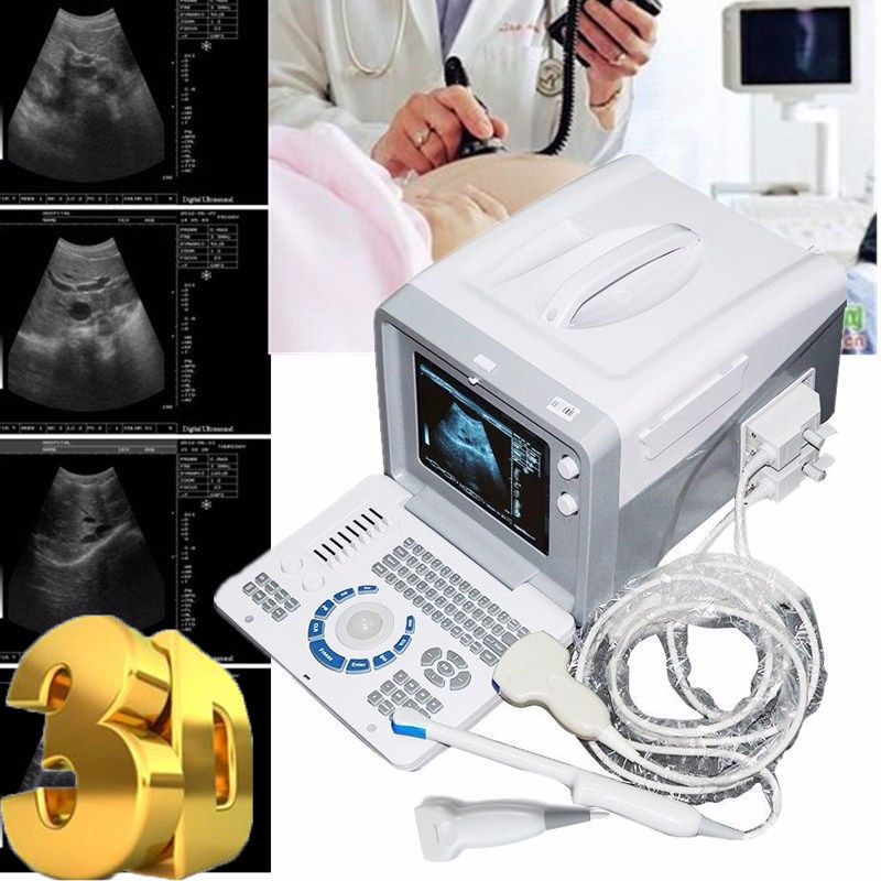 Professional Digital Ultrasound Machine Covex/ Linear/ Transvaginal 3 Probes +3D 190891914545 DIAGNOSTIC ULTRASOUND MACHINES FOR SALE