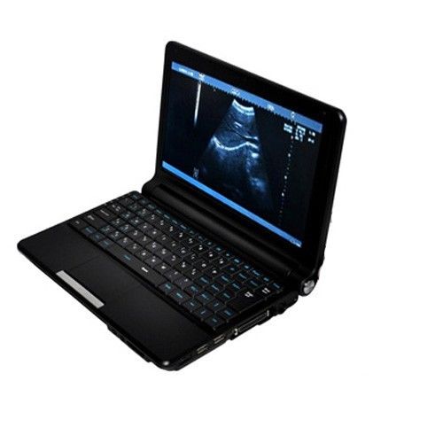 Laptop Ultrasound Scanner Machine 3.5Mhz Convex+ Linear Probes Sale CE 3D DIAGNOSTIC ULTRASOUND MACHINES FOR SALE