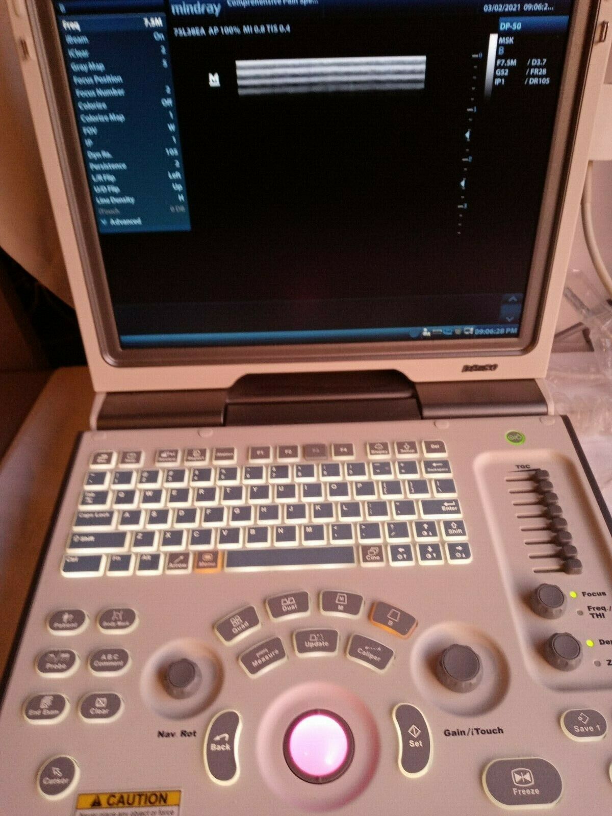 MINDRAY DIGITAL ULTRASOUND DIAGNOSTIC IMAGING SYSTEM,GREAT CONDITION(DP-50)  DIAGNOSTIC ULTRASOUND MACHINES FOR SALE