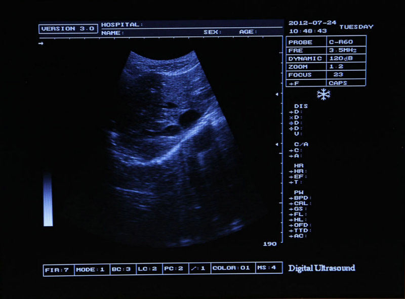 Pro Medical Ultrasound Scanner Scan Convex Linear Transvaginal Probes Pregnancy  190891506153 DIAGNOSTIC ULTRASOUND MACHINES FOR SALE