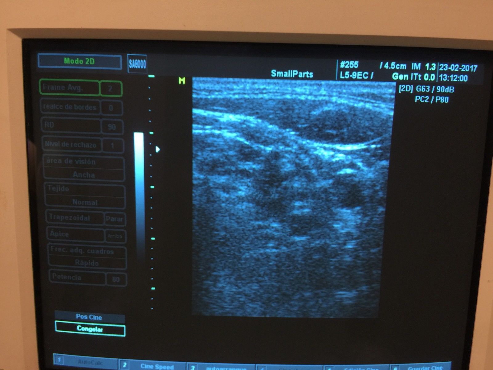 MEDISON L5-9 7.5 MHz Linear Probe FOR SA5500/6000/8800/8000SE/8000EX/8000LV/PICO DIAGNOSTIC ULTRASOUND MACHINES FOR SALE