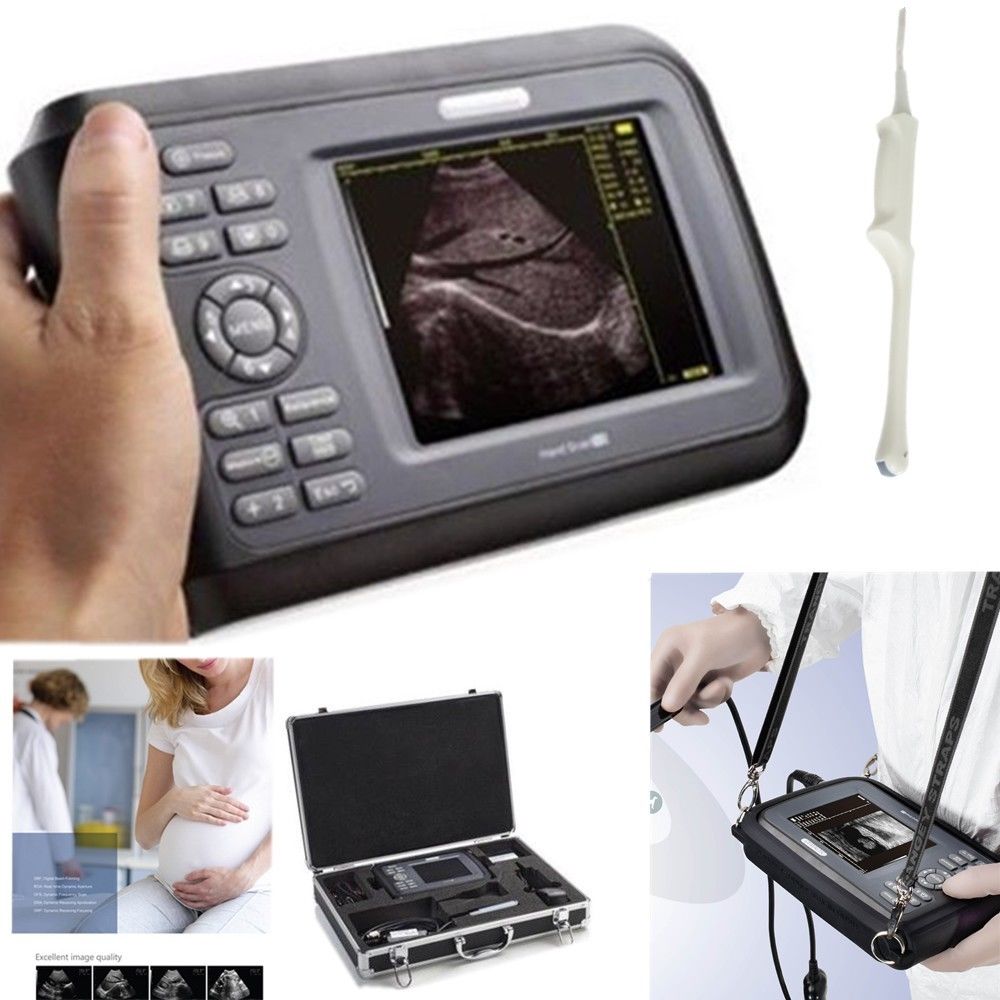 Portable Digital Ultrasound machine Scanner system 6.5 Mhz transvaginal Probe CE DIAGNOSTIC ULTRASOUND MACHINES FOR SALE