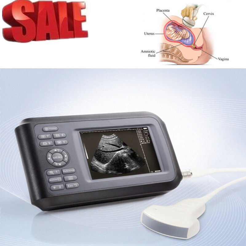 Portable HandScan 5.5'' Digital Ultrasound Scanner Machine+Convex Probe+Oximeter 190891400826 DIAGNOSTIC ULTRASOUND MACHINES FOR SALE