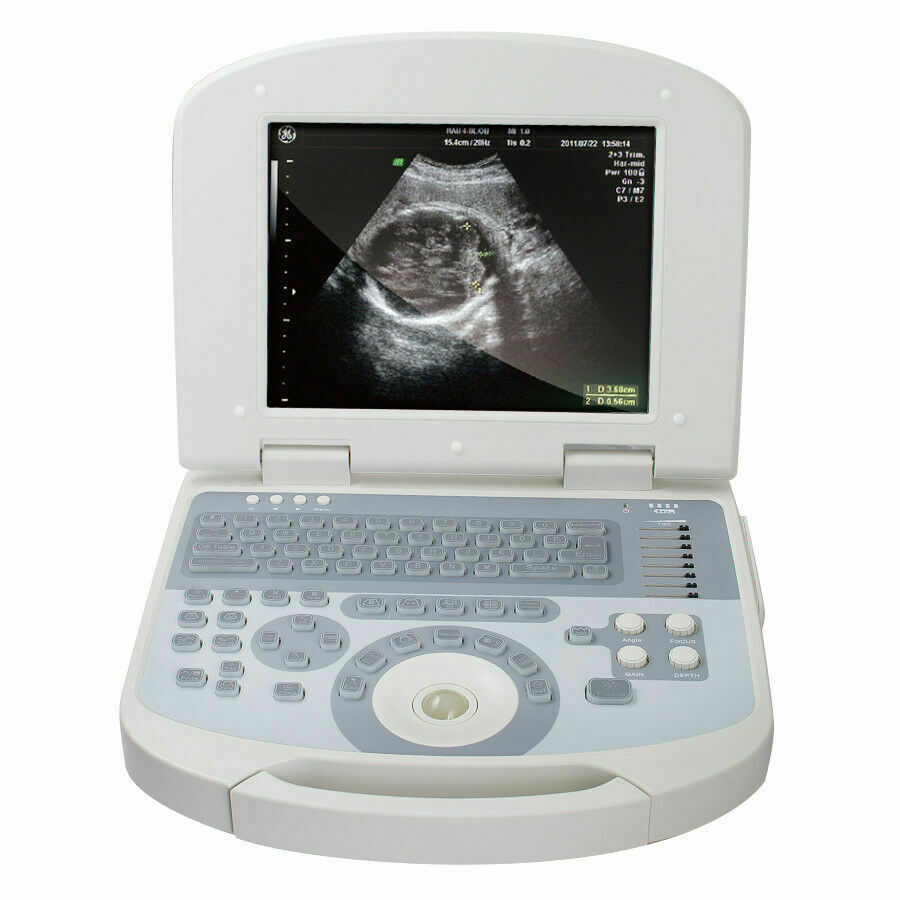 Portable Medical Laptop Diagnostic Ultrasound Scanner 3.5 Convex probe+Free 3D DIAGNOSTIC ULTRASOUND MACHINES FOR SALE