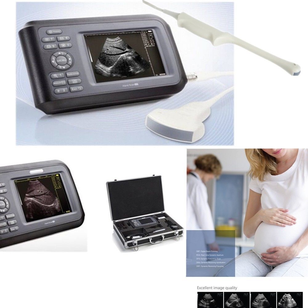 Laptop Machine HandScan Ultrasound scanner Convex + Linear+ Micro convex 3 Probe DIAGNOSTIC ULTRASOUND MACHINES FOR SALE