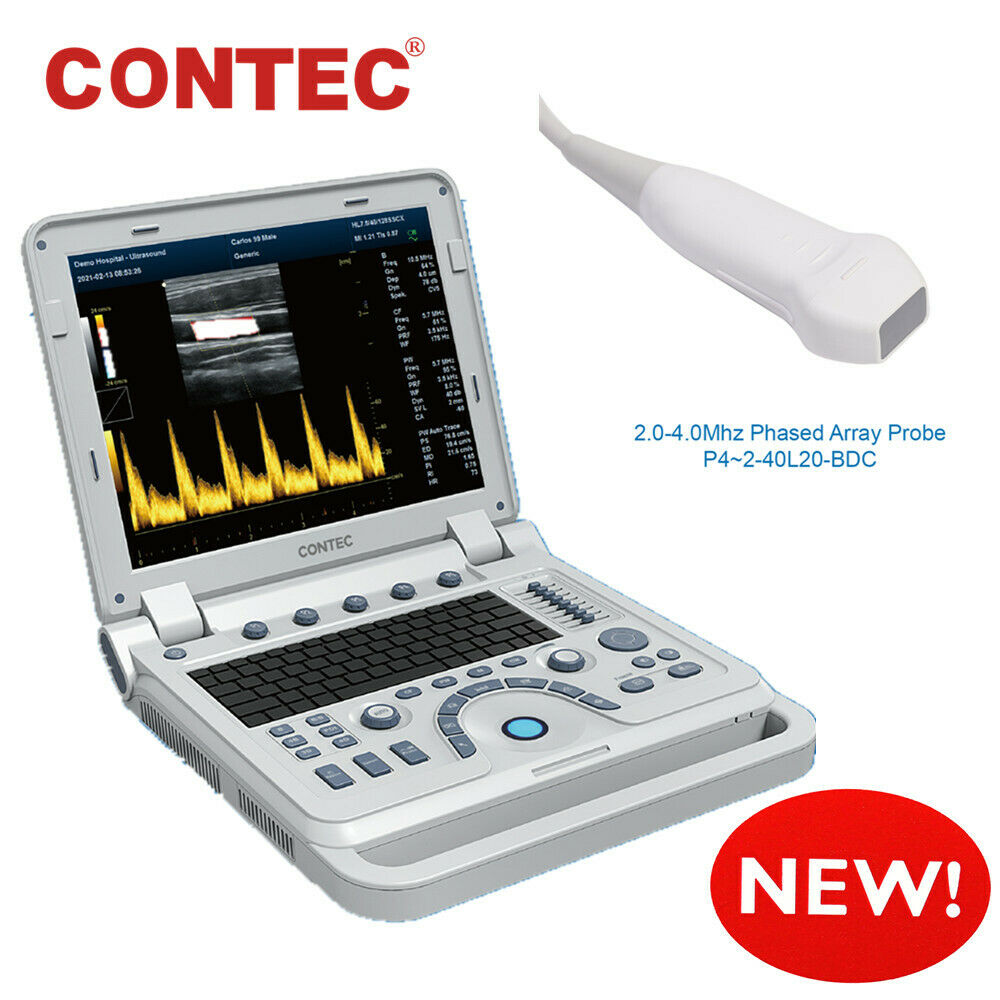 Portable Cardiac Ultrasound Scanner Diagnostic Color Doppler Phased Array Probe 6945040100362 DIAGNOSTIC ULTRASOUND MACHINES FOR SALE
