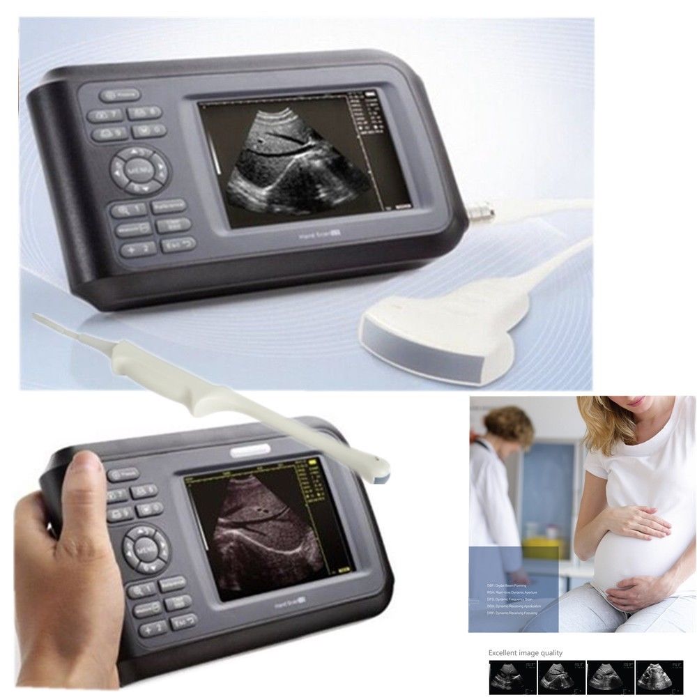 Human Laptop Machine Ultrasound Scanner System Convex + Transvaginal Probe+ Case DIAGNOSTIC ULTRASOUND MACHINES FOR SALE