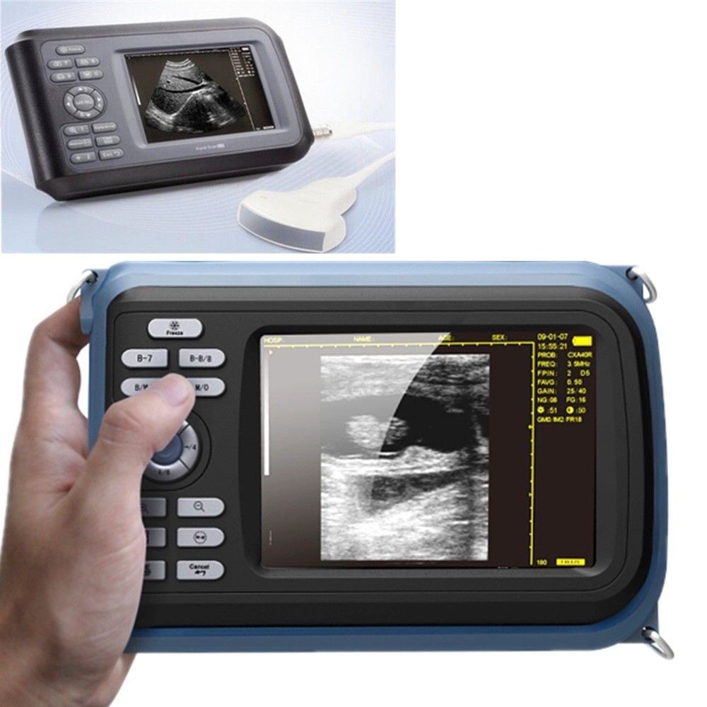Portable Digital Ultrasound machine Scanner system +6.5 Mhz transvaginal Probe DIAGNOSTIC ULTRASOUND MACHINES FOR SALE