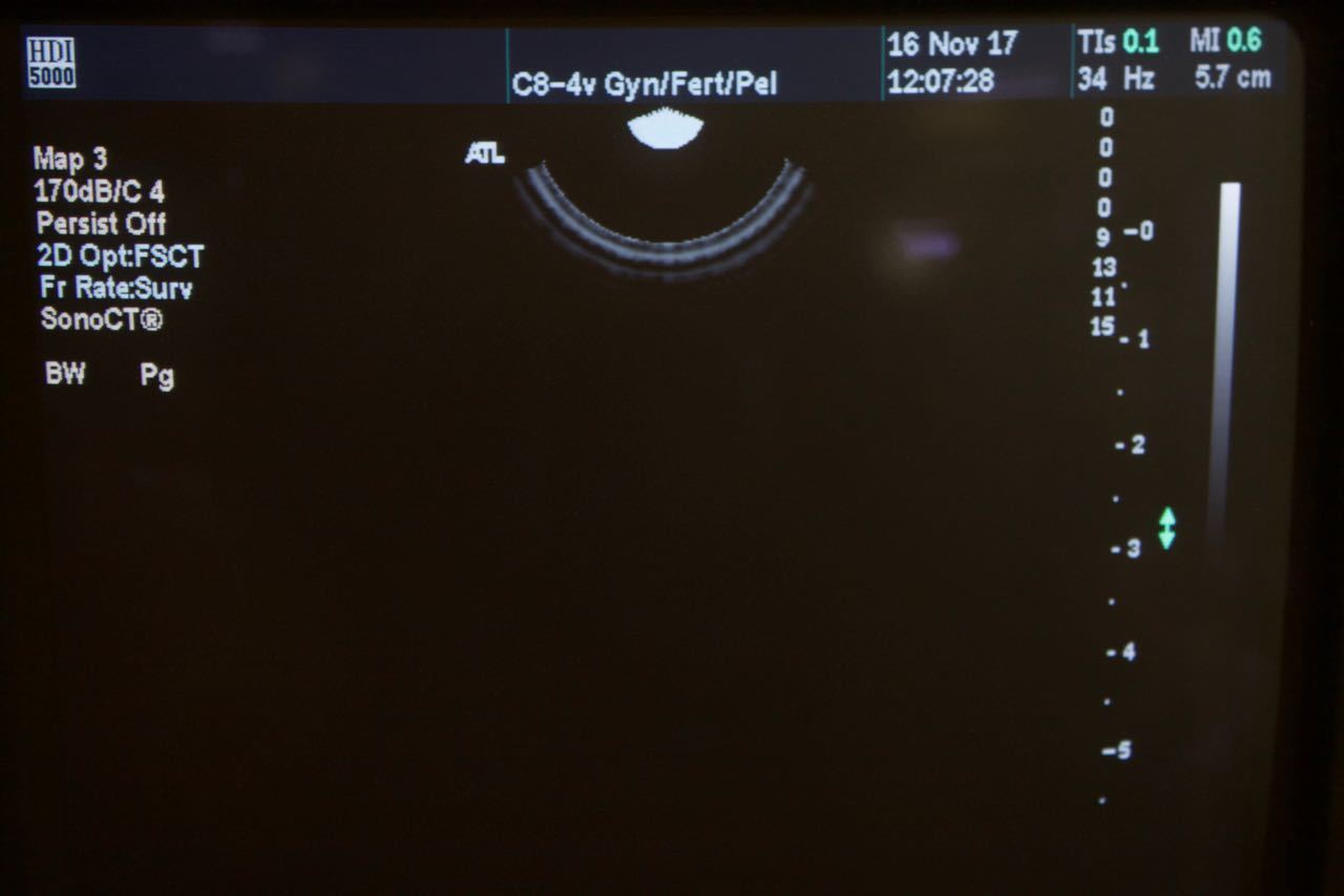 Philips ATL C8-4v Curved Array IVT Ultrasound Transducer HDI5000 4000-0409-04 DIAGNOSTIC ULTRASOUND MACHINES FOR SALE