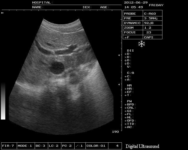 Portable Veterinary Ultrasound Scanner Machine Linear Probe 3D Veterinarian DIAGNOSTIC ULTRASOUND MACHINES FOR SALE