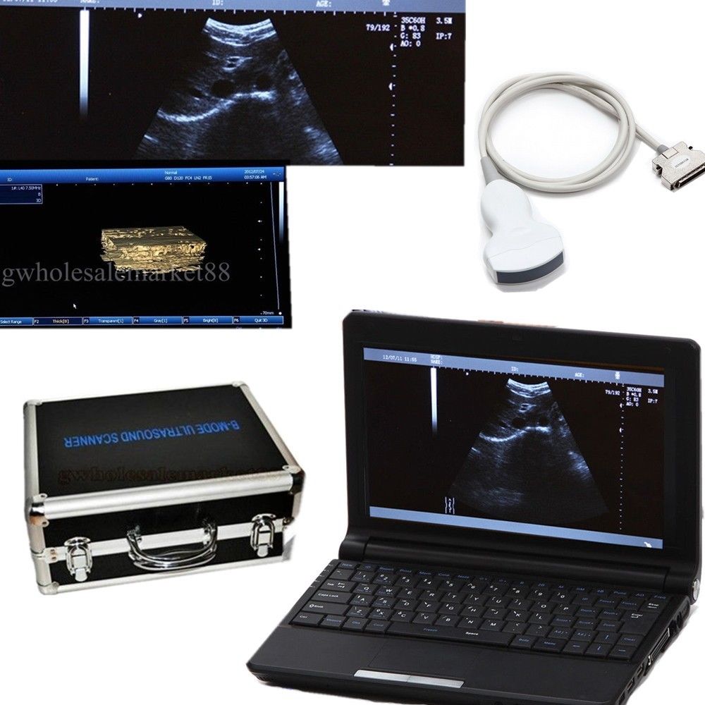Portable Laptop Ultrasound Scanner Machine 3.5M Convex Probe 3D+US SPO2 Oximeter 190891041722 DIAGNOSTIC ULTRASOUND MACHINES FOR SALE
