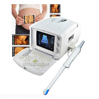 Portable Machine Digital Ultrasound Scanner Transvaginal Probe 3D Software Price 190891982230 DIAGNOSTIC ULTRASOUND MACHINES FOR SALE