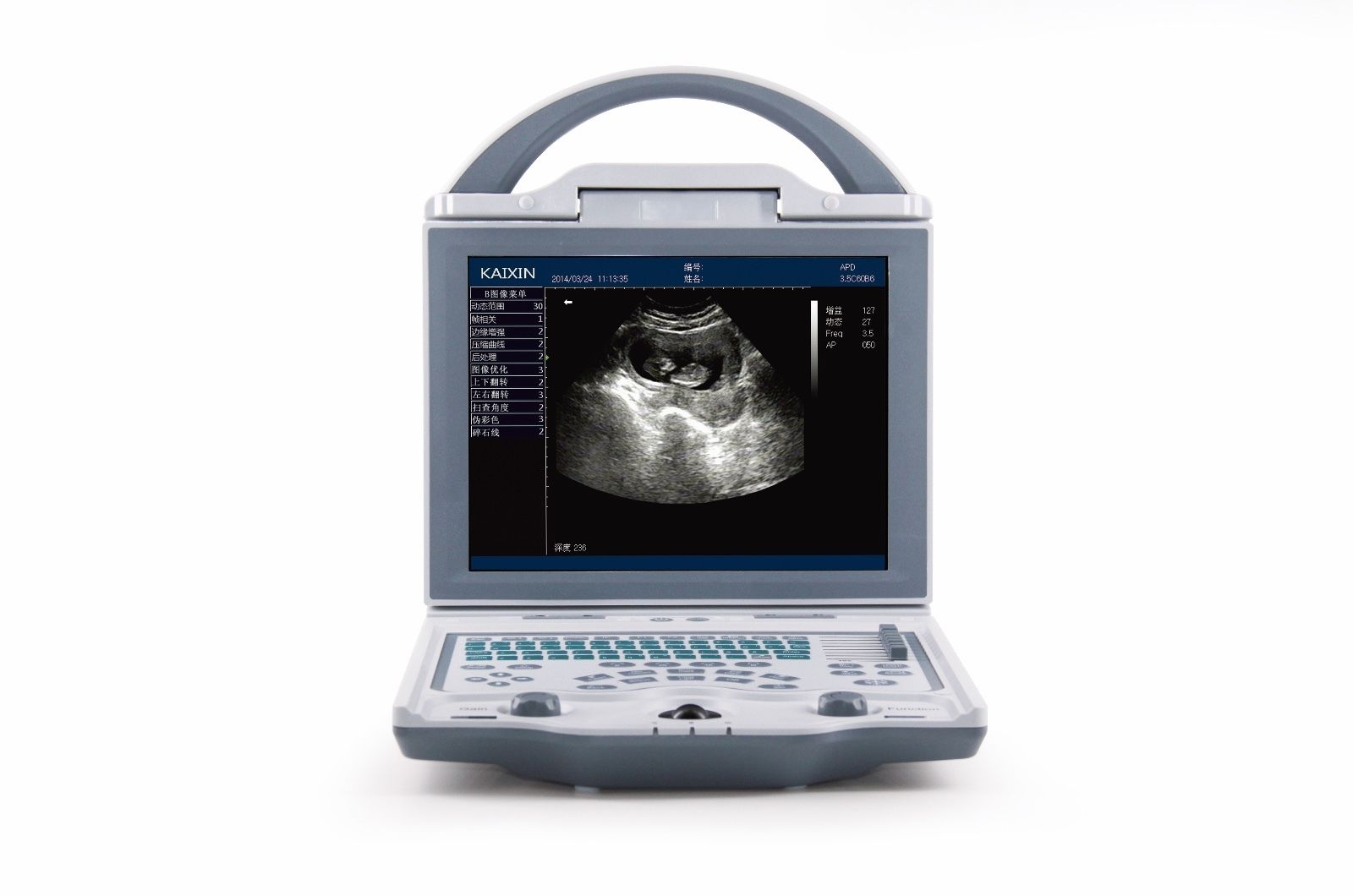 Mixed Practice Veterinary Animal Ultrasound Scanner&Rectal&Micro Convex, KX5600V DIAGNOSTIC ULTRASOUND MACHINES FOR SALE