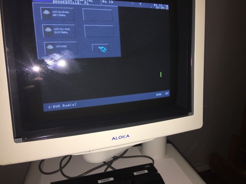 Aloka SSD-ALPH5 Ultrasound Machine + Sony Printer + DVD recorder DIAGNOSTIC ULTRASOUND MACHINES FOR SALE