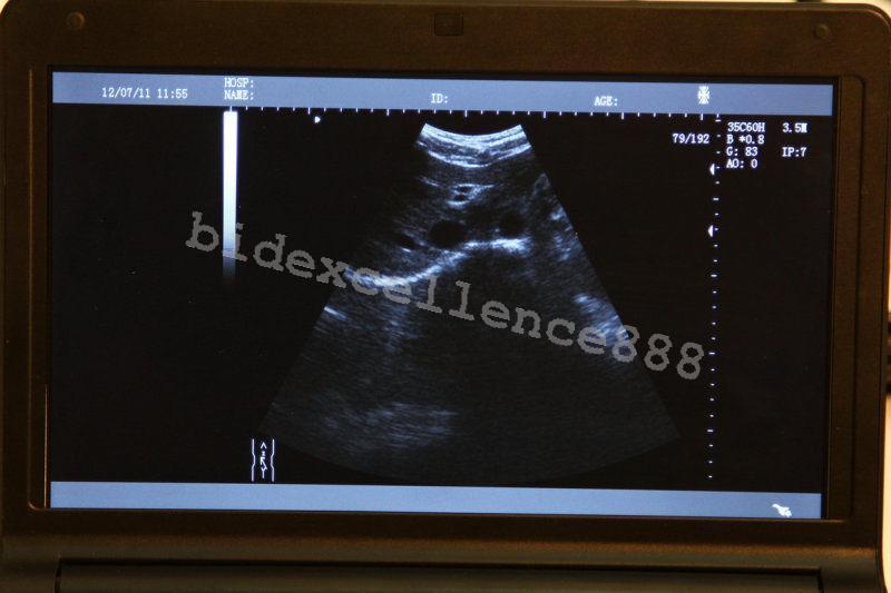 Portable Laptop Ultrasound Scanner Diagnostic machine Convex Probe 3D OximeterAA 190891895424 DIAGNOSTIC ULTRASOUND MACHINES FOR SALE