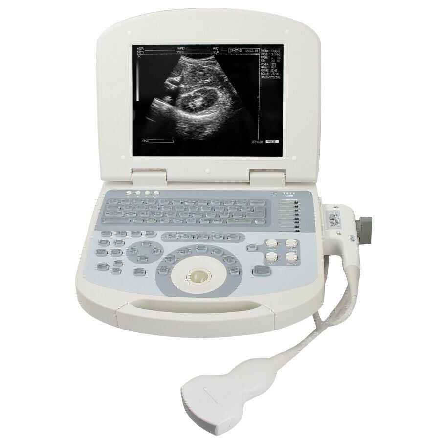 Portable laptop machine Full Digital Ultrasound Ultrasonic scanner Convex probe DIAGNOSTIC ULTRASOUND MACHINES FOR SALE