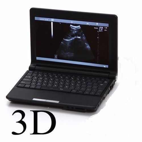 Laptop Ultrasound scanner with Transvaginal probe 3D B ultrasonic Machine Sale 190891734143 DIAGNOSTIC ULTRASOUND MACHINES FOR SALE