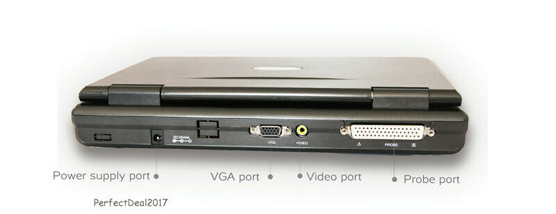 Laptop Ultrasound Machine, Notebook Digital Ultrasound scanner, 3.5 Convex probe DIAGNOSTIC ULTRASOUND MACHINES FOR SALE