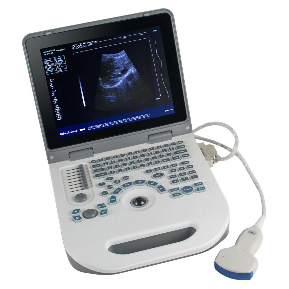 Portable Ultrasound Scanner Diagnostic Machine Laptop 3.5MHz Convex array Probe DIAGNOSTIC ULTRASOUND MACHINES FOR SALE