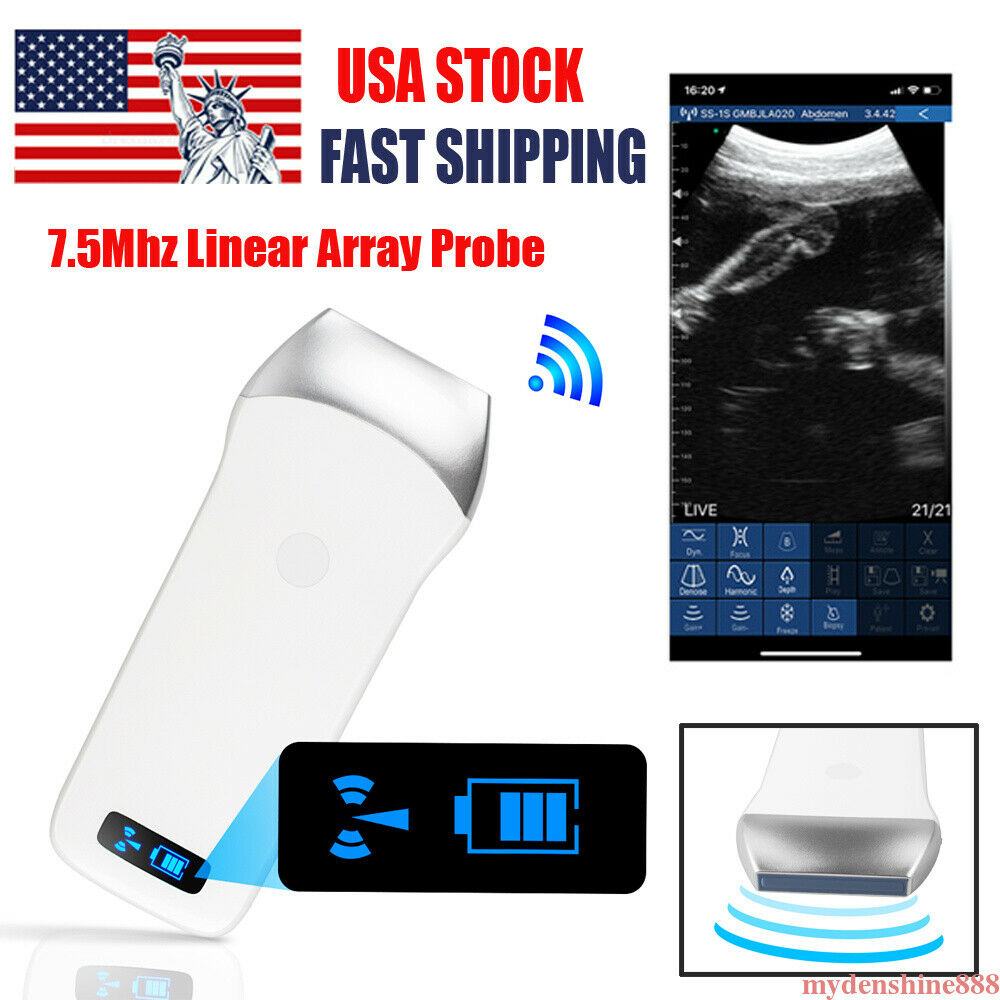 Portable WIFI Wireless Ultrasound Scanner Machine System Linear Probe 7.5Mhz DIAGNOSTIC ULTRASOUND MACHINES FOR SALE