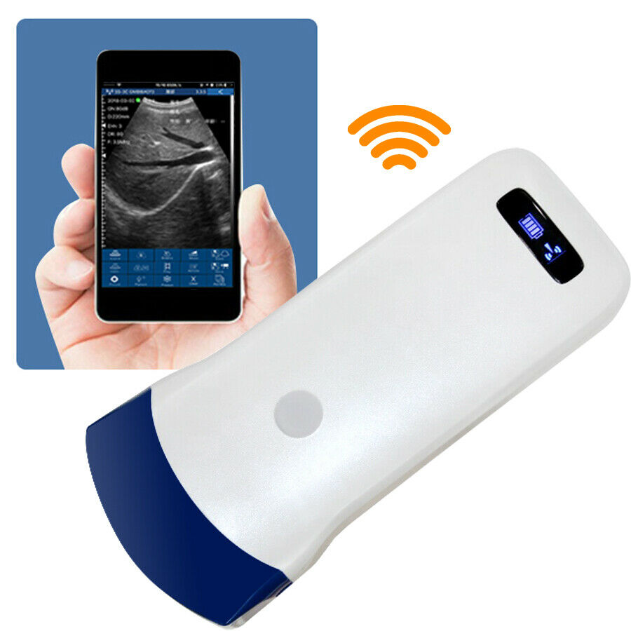 Portable Wireless WIFI Ultrasound Scanner Color Doppler Convex Probe 128 Element DIAGNOSTIC ULTRASOUND MACHINES FOR SALE