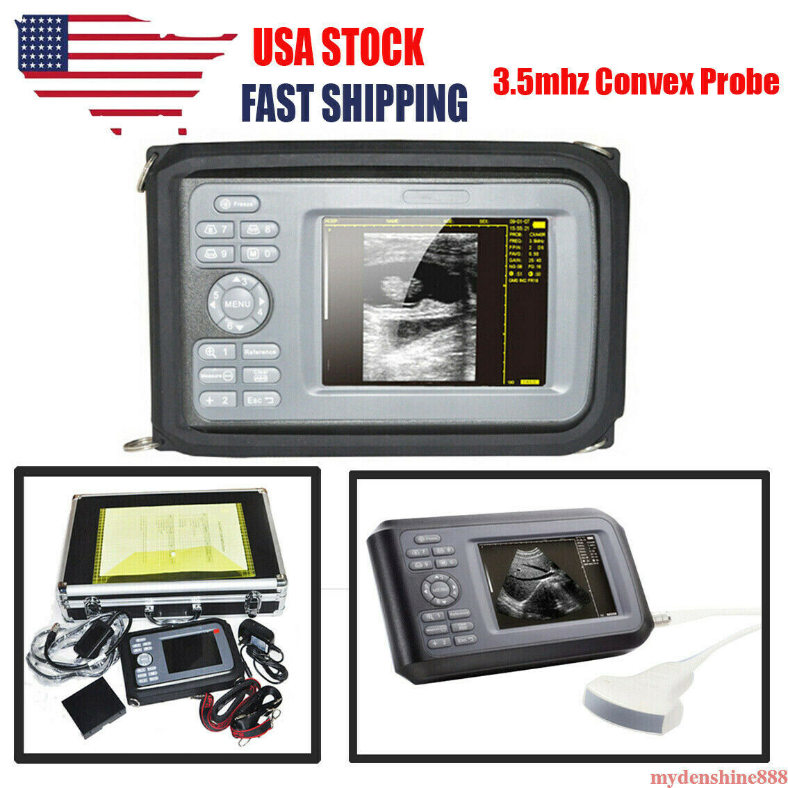 Portable Handheld Human Ultrasound Scanner Machine + 3.5mhz Convex Probe + Case DIAGNOSTIC ULTRASOUND MACHINES FOR SALE